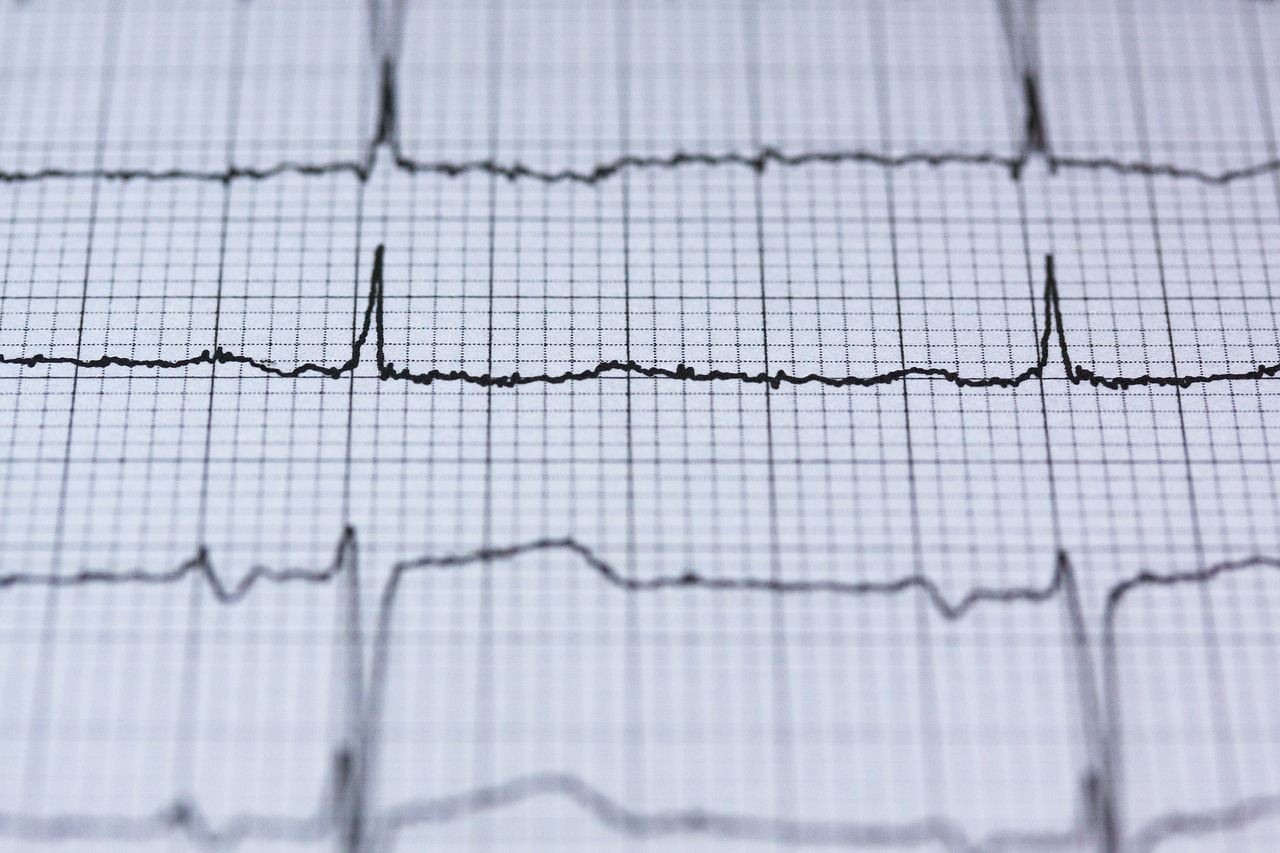 ecg-curve